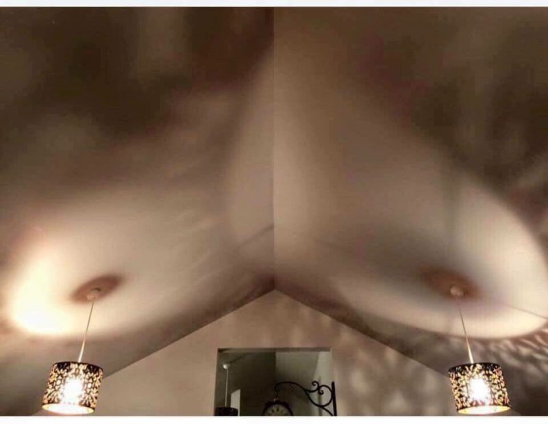 Breast lights.jpg
